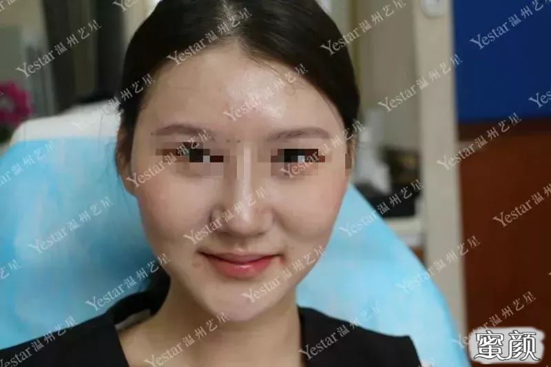 案例图片