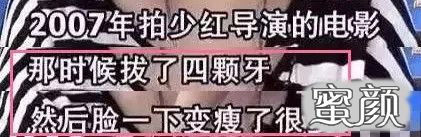 https://img.yiyiaimei.com/mnt/timg/200511/155S54b0-0.jpg 案例图片