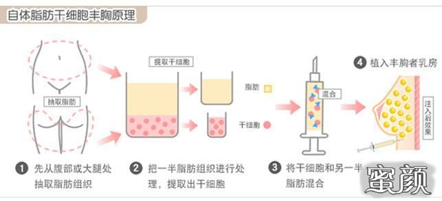 案例图片