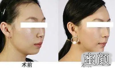 https://img.yiyiaimei.com/mnt/timg/200512/14051Q957-6.jpg