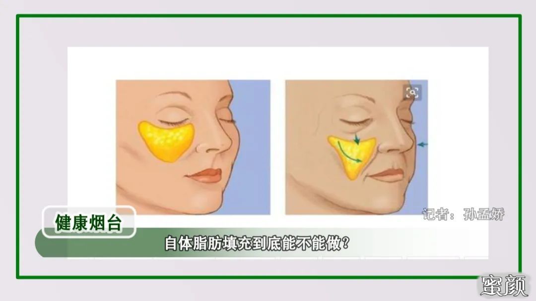 https://img.yiyiaimei.com/mnt/timg/200512/144U5L51-0.jpg 案例图片
