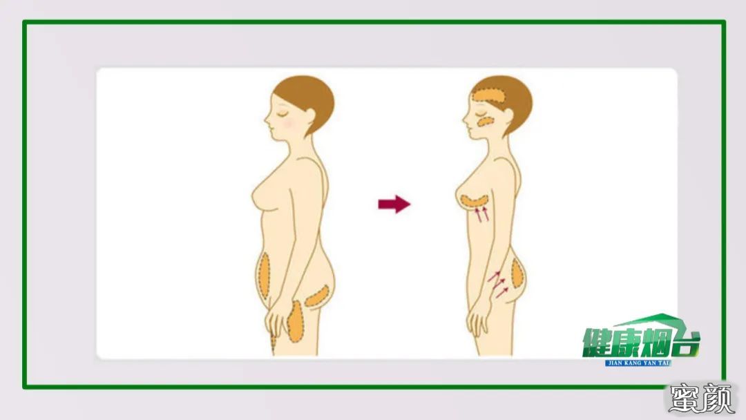https://img.yiyiaimei.com/mnt/timg/200512/144UC962-3.jpg 案例图片