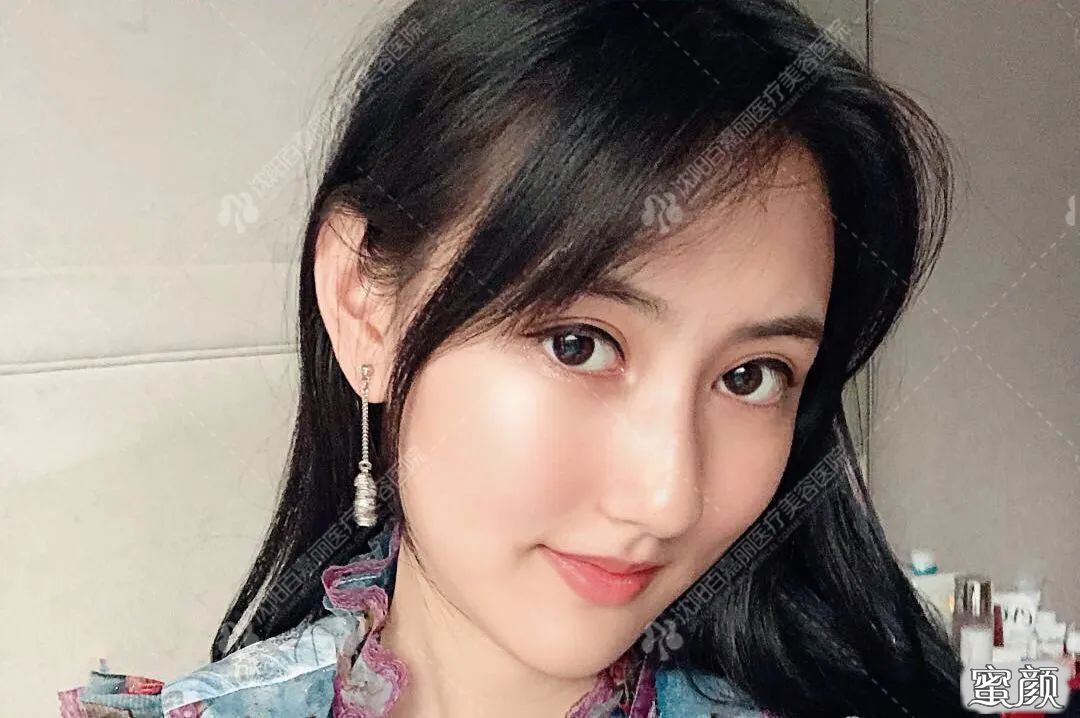 案例图片