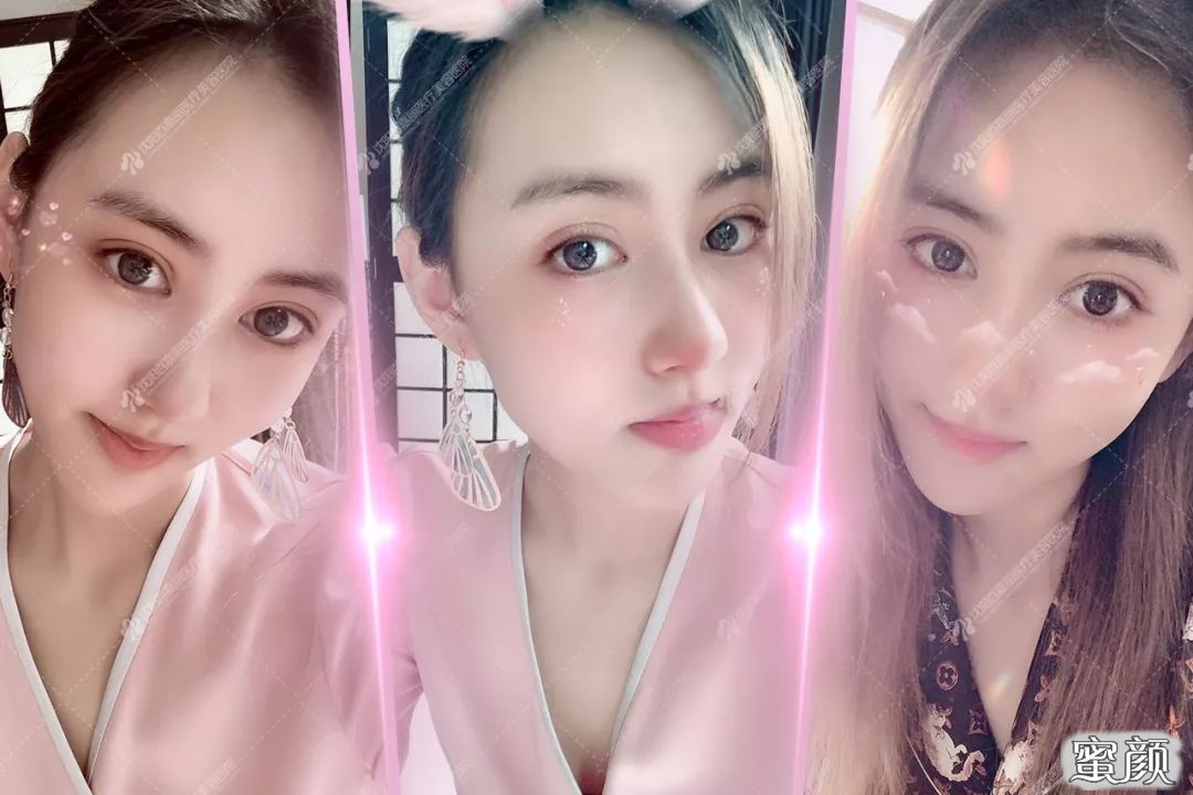 https://img.yiyiaimei.com/mnt/timg/200512/15110LA4-6.jpg 案例图片