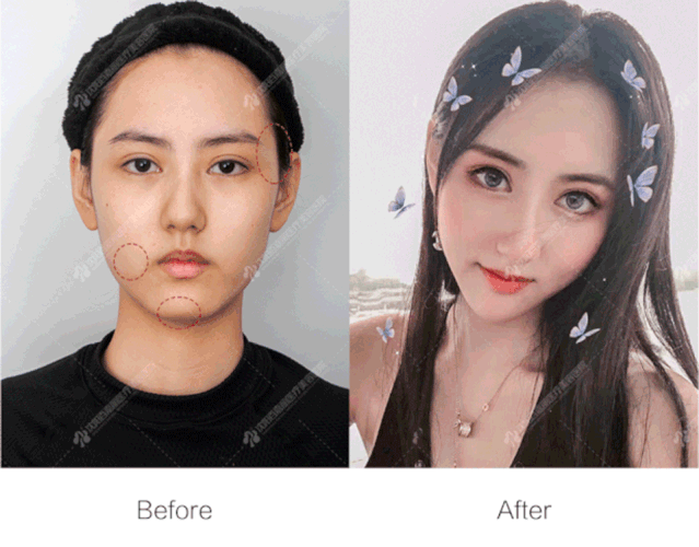 案例图片