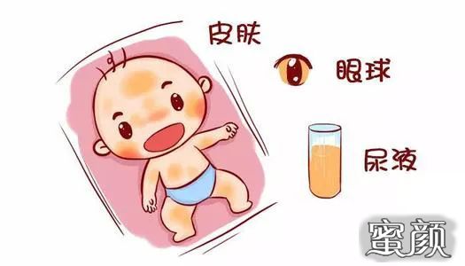 https://img.yiyiaimei.com/mnt/timg/200512/151633NF-1.jpg