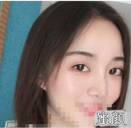 案例图片
