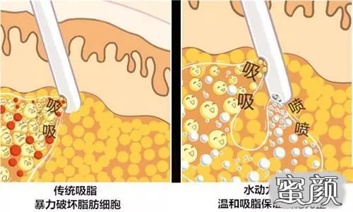 https://img.yiyiaimei.com/mnt/timg/200513/14005111C-2.jpg