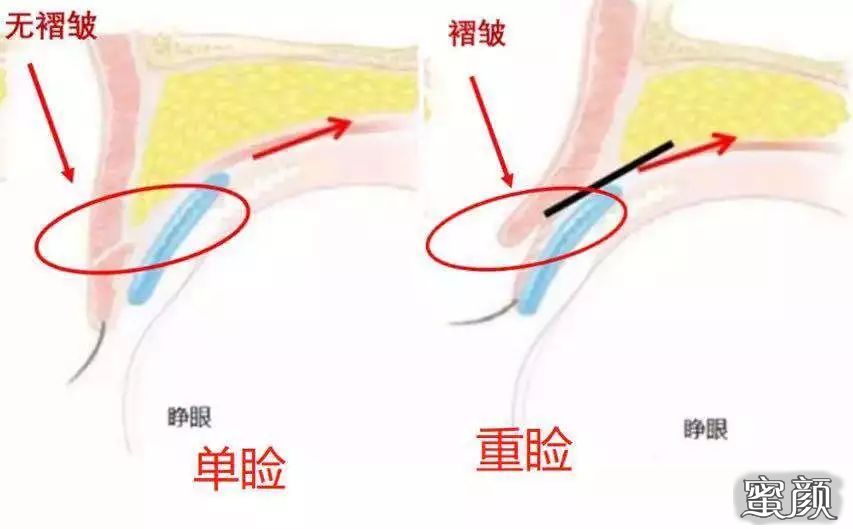 案例图片