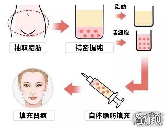 https://img.yiyiaimei.com/mnt/timg/200514/1139193924-1.jpg