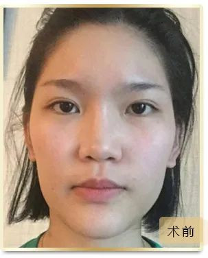 案例图片