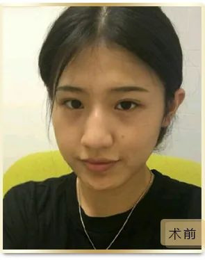 https://img.yiyiaimei.com/mnt/timg/200514/11411RQ1-4.jpg 案例图片