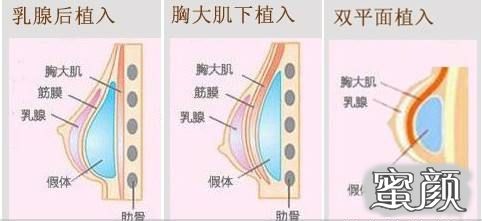 案例图片