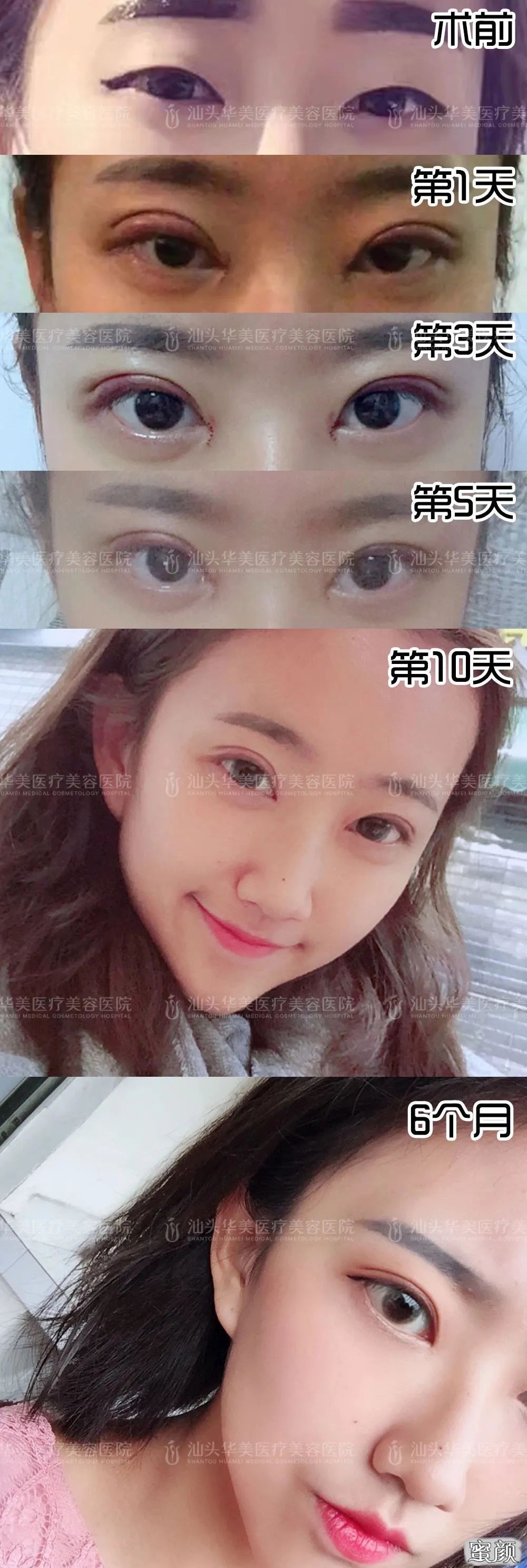 https://img.yiyiaimei.com/mnt/timg/200514/1236143592-1.jpg