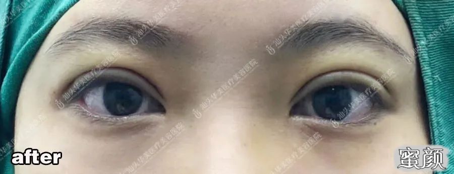 https://img.yiyiaimei.com/mnt/timg/200514/1236212540-7.jpg