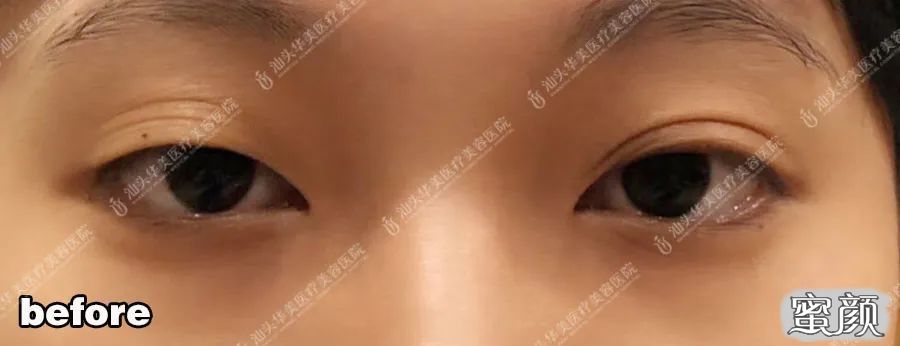 https://img.yiyiaimei.com/mnt/timg/200514/1236213304-6.jpg