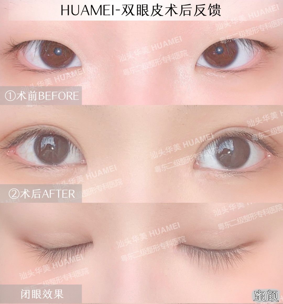 https://img.yiyiaimei.com/mnt/timg/200514/123641FR-10.jpg