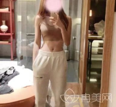 案例图片