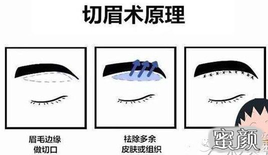 案例图片