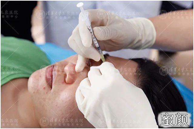 https://img.yiyiaimei.com/mnt/timg/200514/14301aY3-1.jpg 案例图片