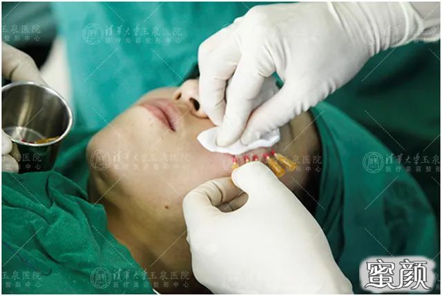 https://img.yiyiaimei.com/mnt/timg/200514/143020A45-4.jpg 案例图片