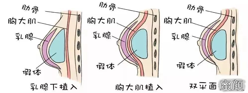 案例图片