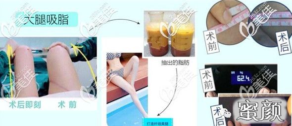 案例图片