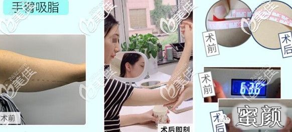 案例图片