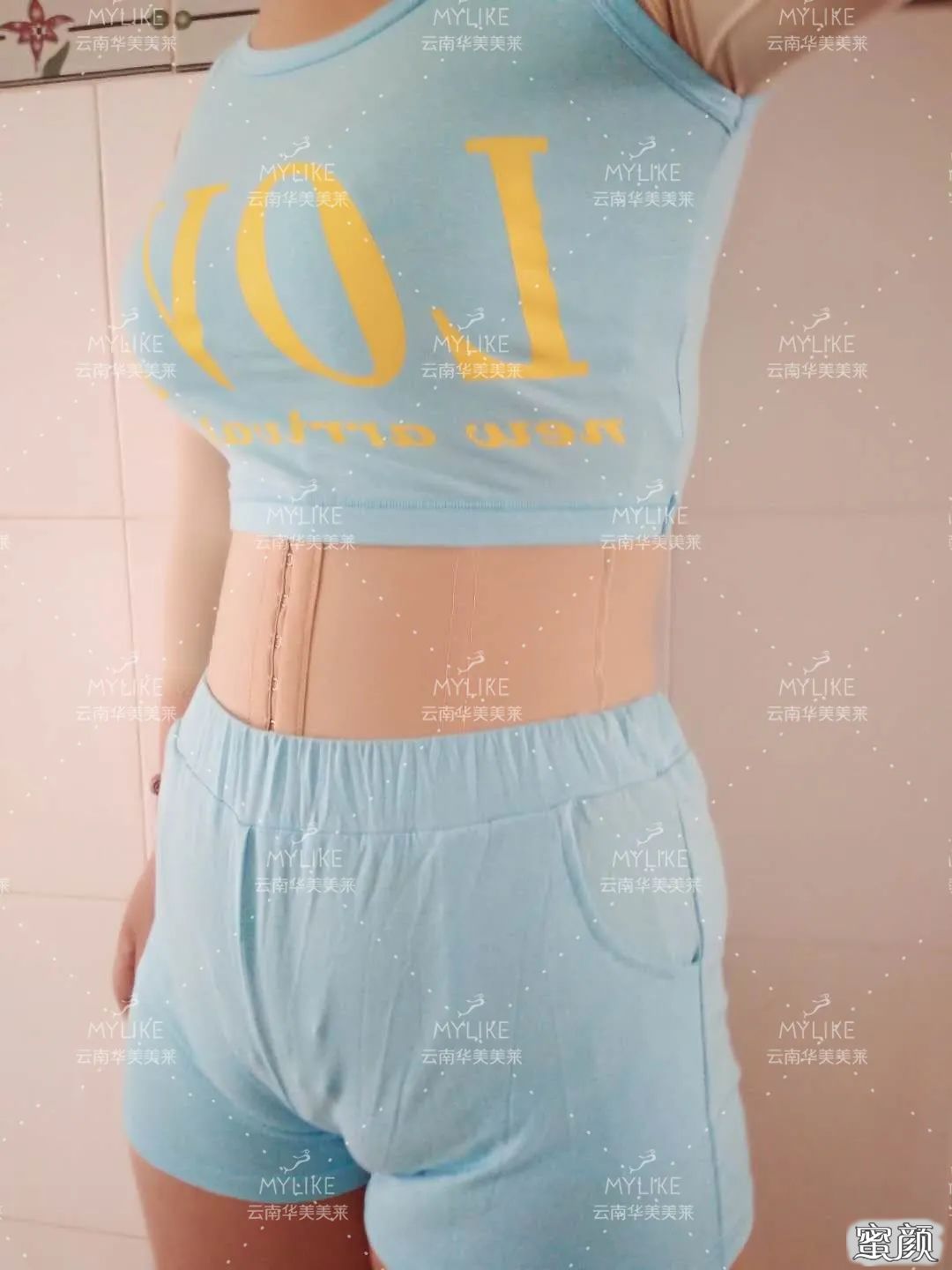 https://img.yiyiaimei.com/mnt/timg/200515/140K1LW-0.jpg 案例图片