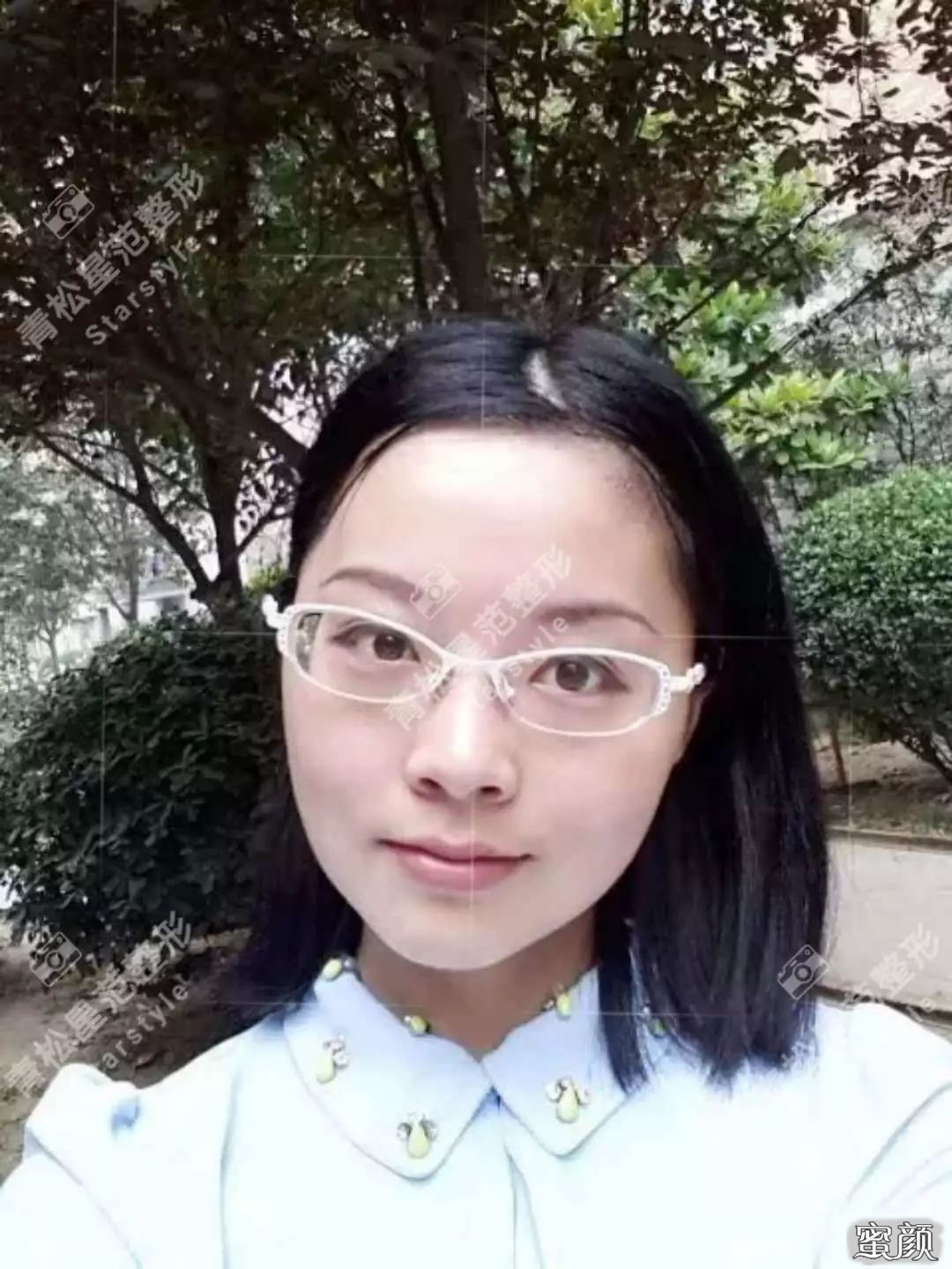 案例图片