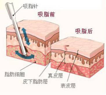 案例图片