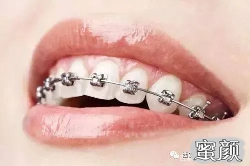 https://img.yiyiaimei.com/mnt/timg/200516/12292W5a-2.jpg