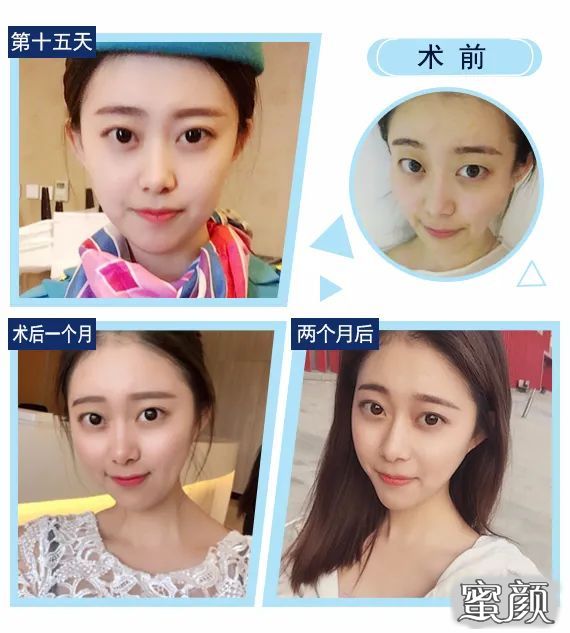 案例图片