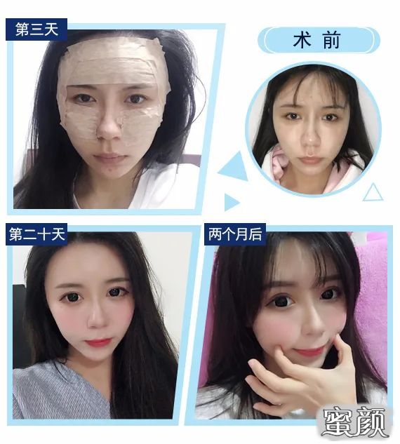 案例图片
