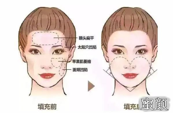 案例图片