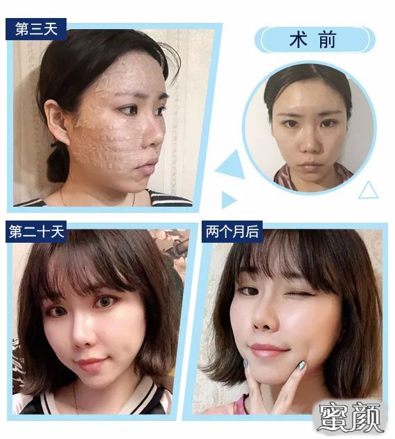 案例图片