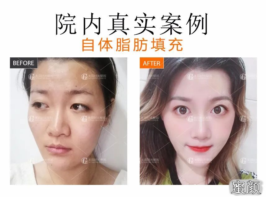 案例图片