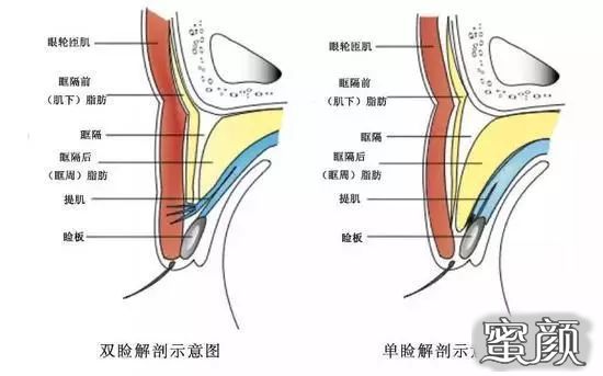 案例图片