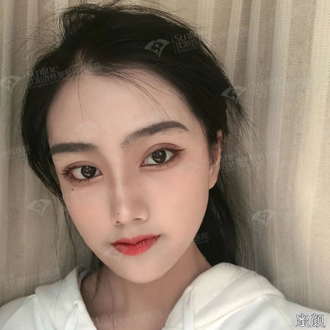 案例图片