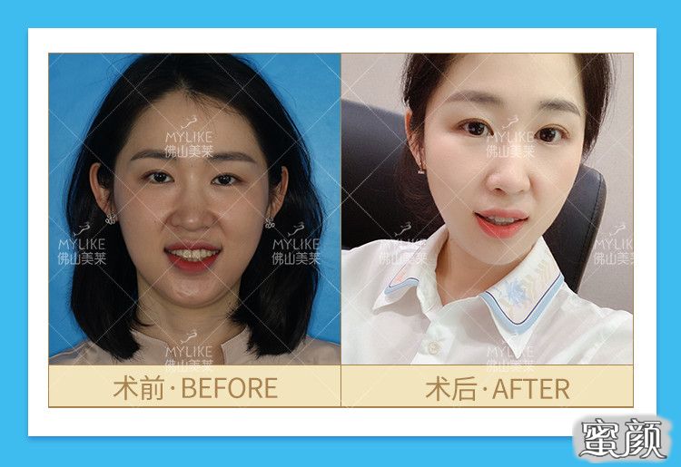 https://img.yiyiaimei.com/mnt/timg/200517/134F15229-12.jpg
