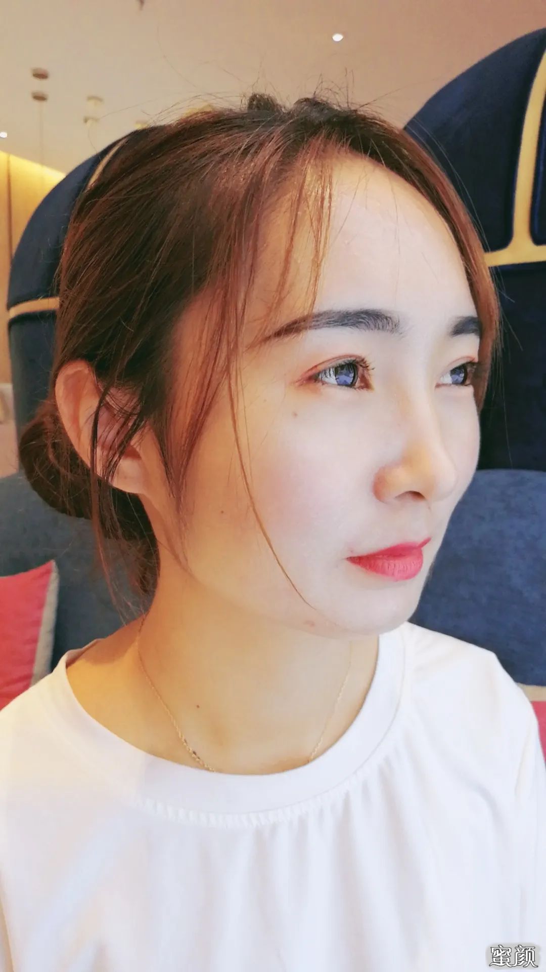 https://img.yiyiaimei.com/mnt/timg/200517/135504C46-0.jpg 案例图片