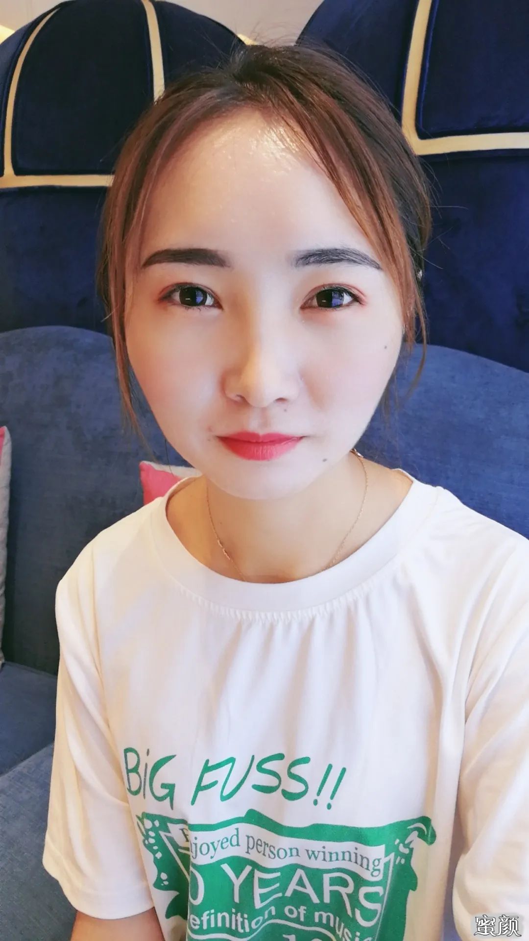 https://img.yiyiaimei.com/mnt/timg/200517/1355062Q6-1.jpg 案例图片