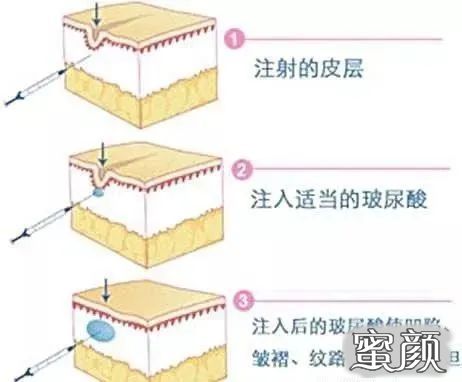 案例图片