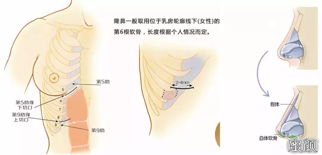 案例图片