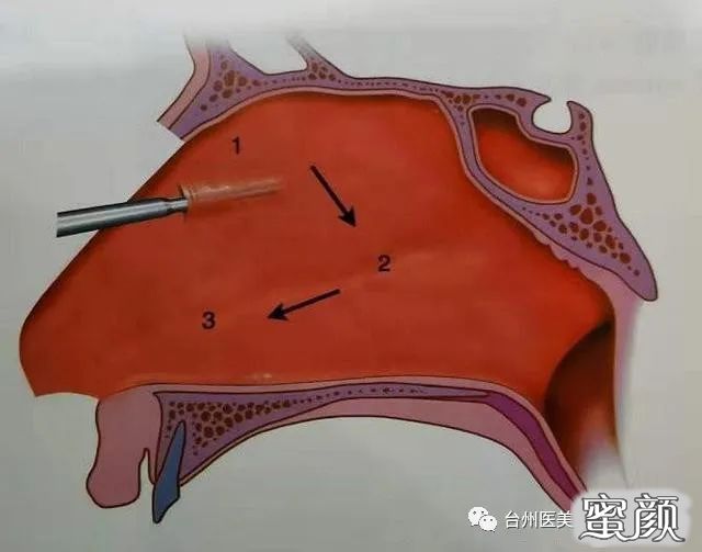 案例图片