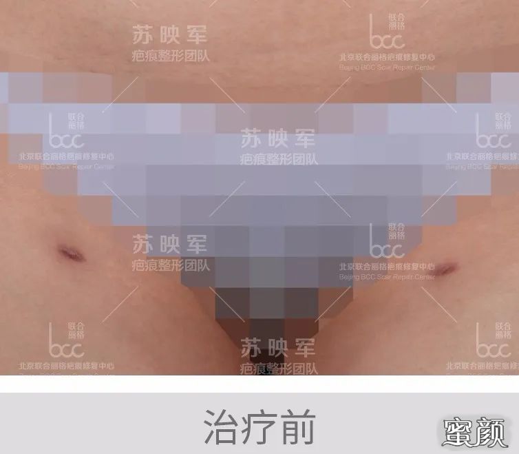 案例图片