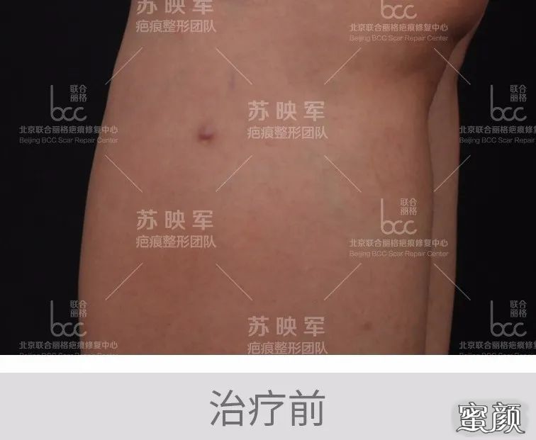 案例图片