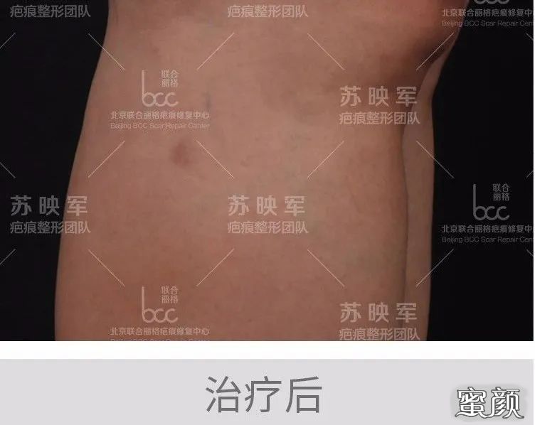 案例图片