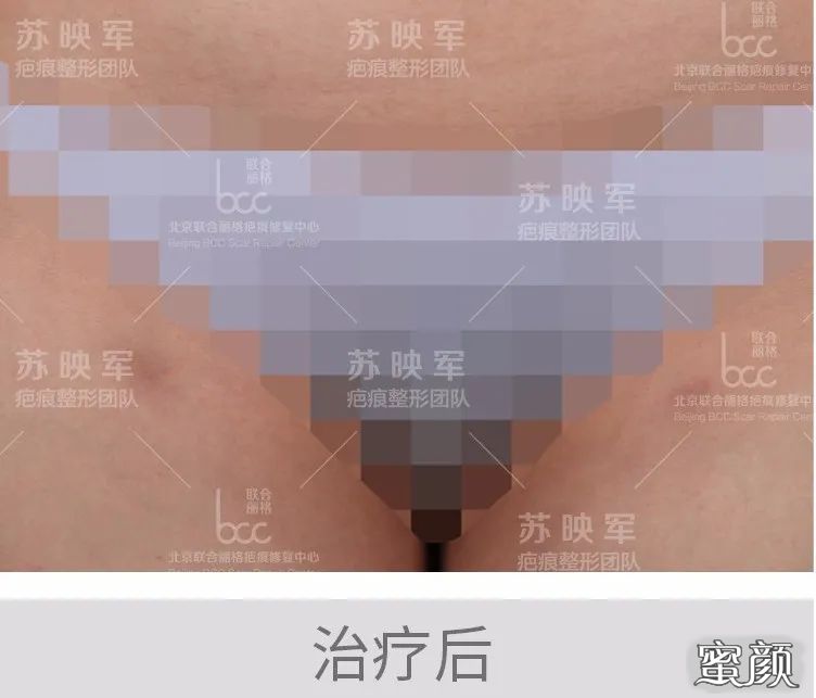 案例图片
