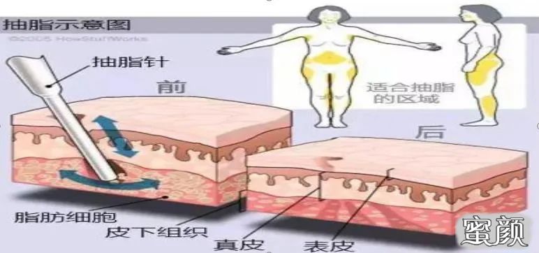 案例图片